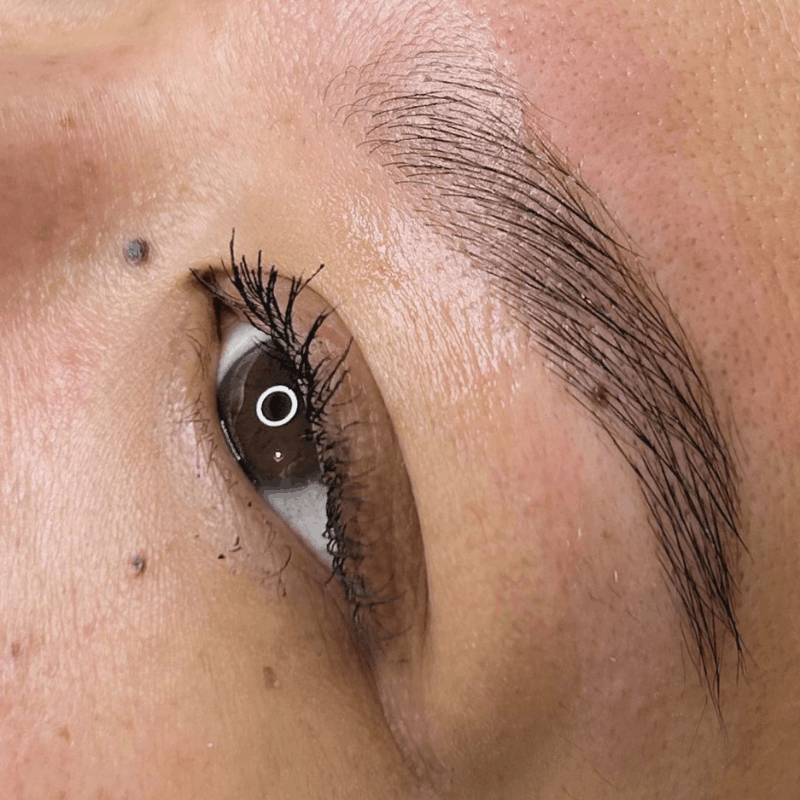 Prestation Browlift
